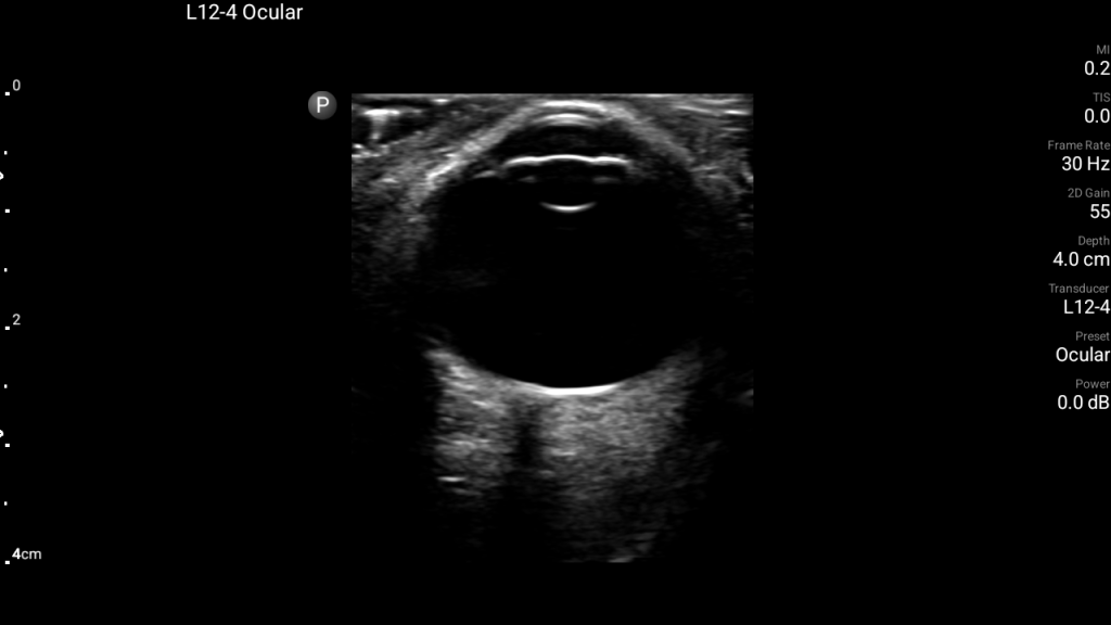 Lumify ocular L12-4